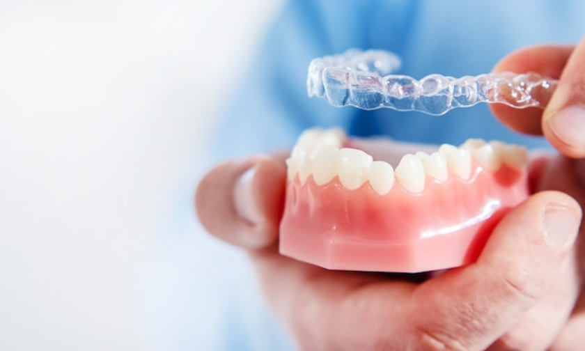 Featured image for “How To Maximize The Benefits of Invisalign”