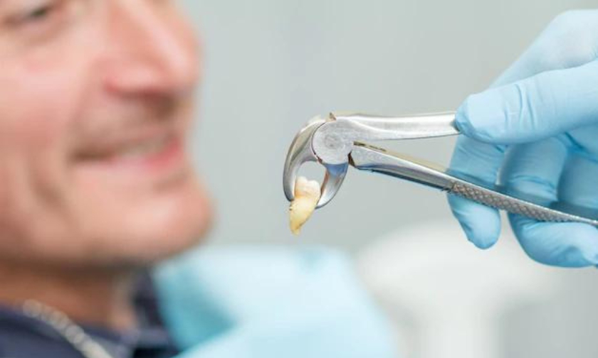 Featured image for “5 Tips for Faster Recovery After Tooth Extraction”