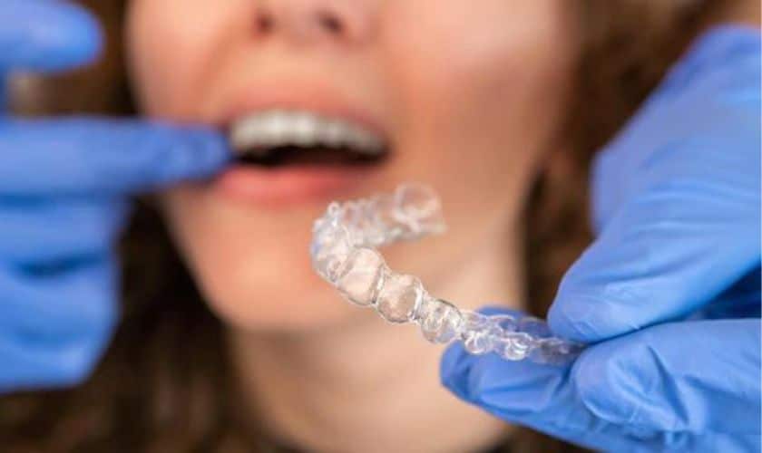 Featured image for “Maintaining Oral Health with Invisalign in Fort Walton Beach”