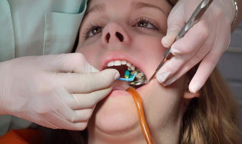 Featured image for “Exploring Non-Metal Solutions: The Future of Tooth Bonding & Fillings”