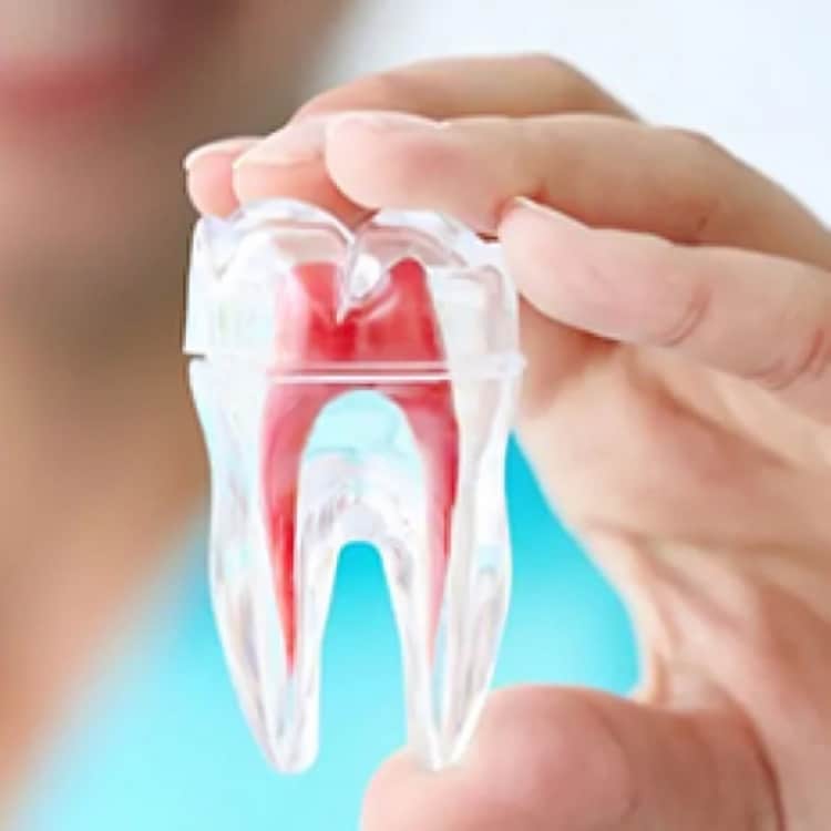 Hand holding anatomical tooth model showing internal pulp chamber and root canal structure.