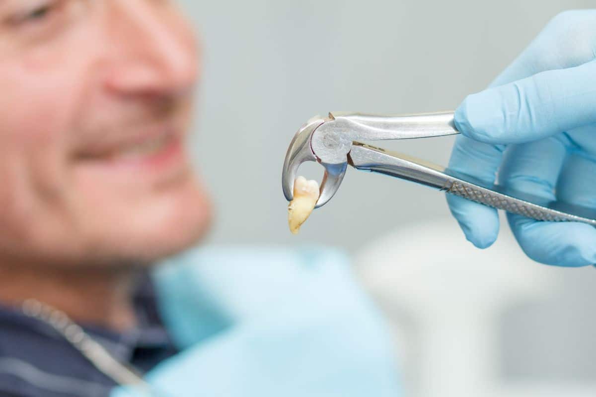 Featured image for “Wisdom Tooth Removal: Aftercare Tips & Tricks”