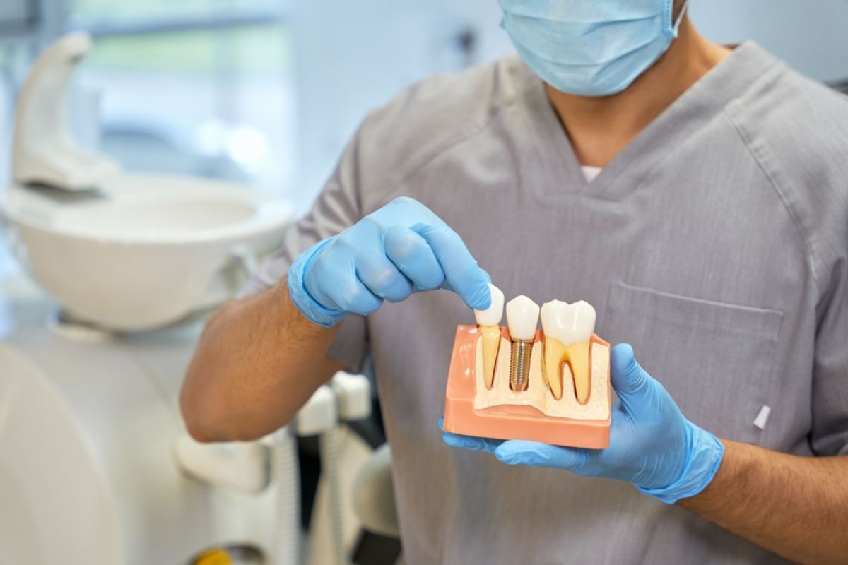 Caring for Dental Implants