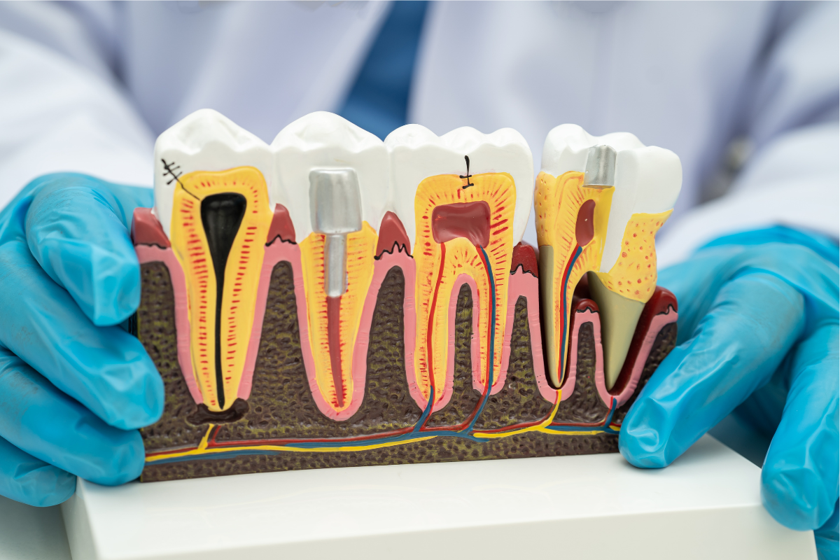 Featured image for “Don’t Ignore the Pain: When to Consider a Root Canal”