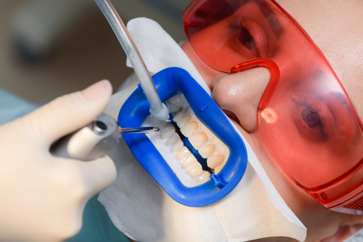 Featured image for “Transform Your Smile with Help from a Cosmetic Dentist in Fort Walton Beach”
