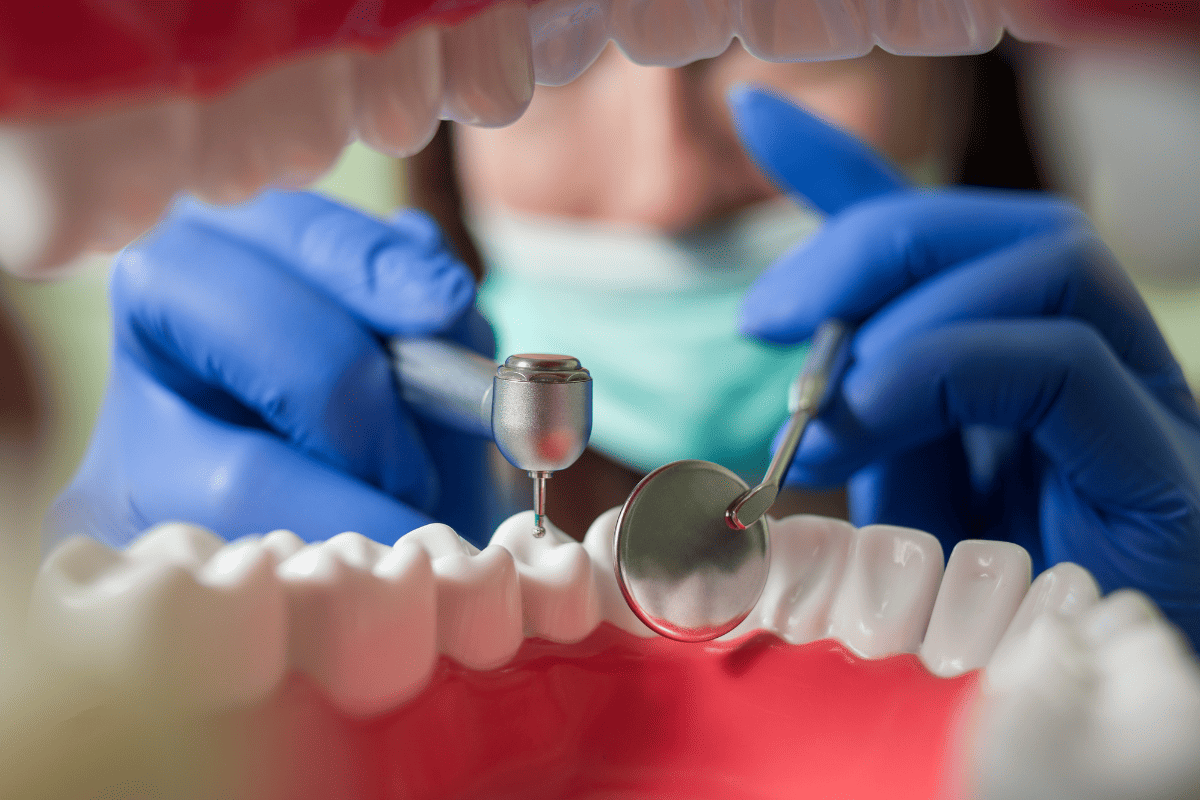 Featured image for “Why Teeth Whitening Alone Doesn’t Fix Every Smile Concern”