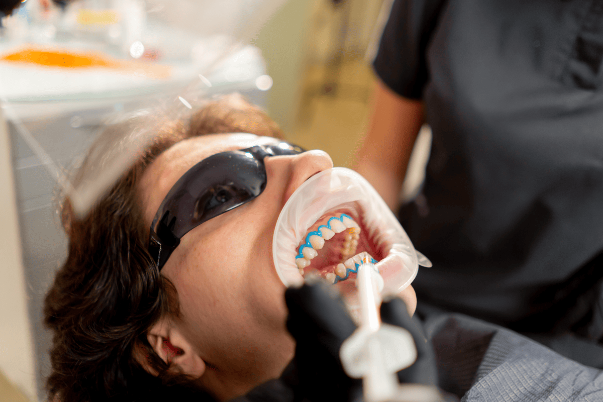 Featured image for “How to Maintain Your Teeth Whitening Results Longer”